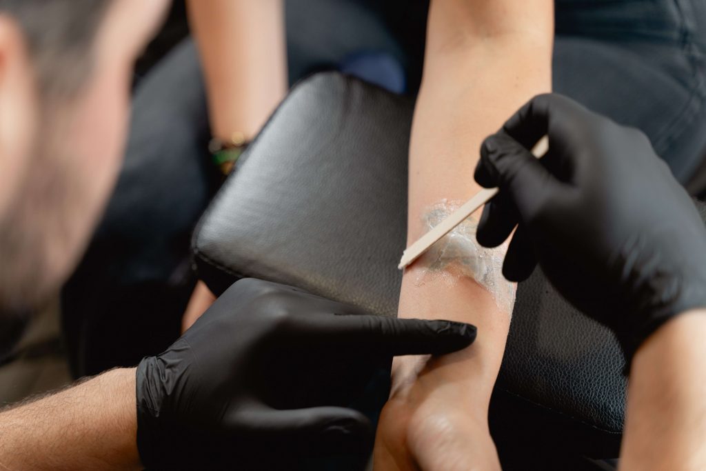 Imagen ilustrativa del post-tratamiento láser